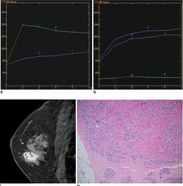 Fig. 1. 43-year-old female patient.
