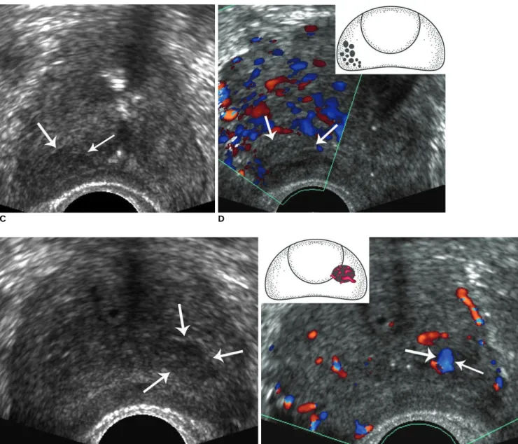 Fig. 1. Scoring system for focal suspicious lesions.