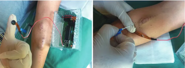 Figure 2. Skin stimulation method