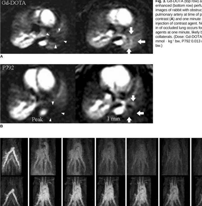 Fig. 4. Gd-DOTA (top row) and P792-enhanced (bottom row) images of two different rabbits, acquired at 3 seconds (A), 30 seconds (B), 1 (C), 3 (D), 5 (E), 10 (F) and 15 minutes (G) after contrast injection