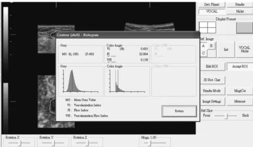 Fig. 1. Virtual organ computer-aided analysis (VOCAL)-imaging program can calculate histogram indices automatically since contour is defined and is accepted.