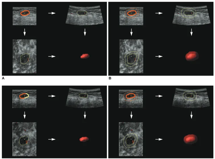 Fig. 2. Cubes enclosing vessels of (A) intra-tumor, (B) outside shell thickness of 3 mm surrounding breast tumor for non-harmonic 3D power Doppler imaging, (C) intra-tumor and (D) outside shell thickness of 3 mm surrounding breast tumor for harmonic 3D pow