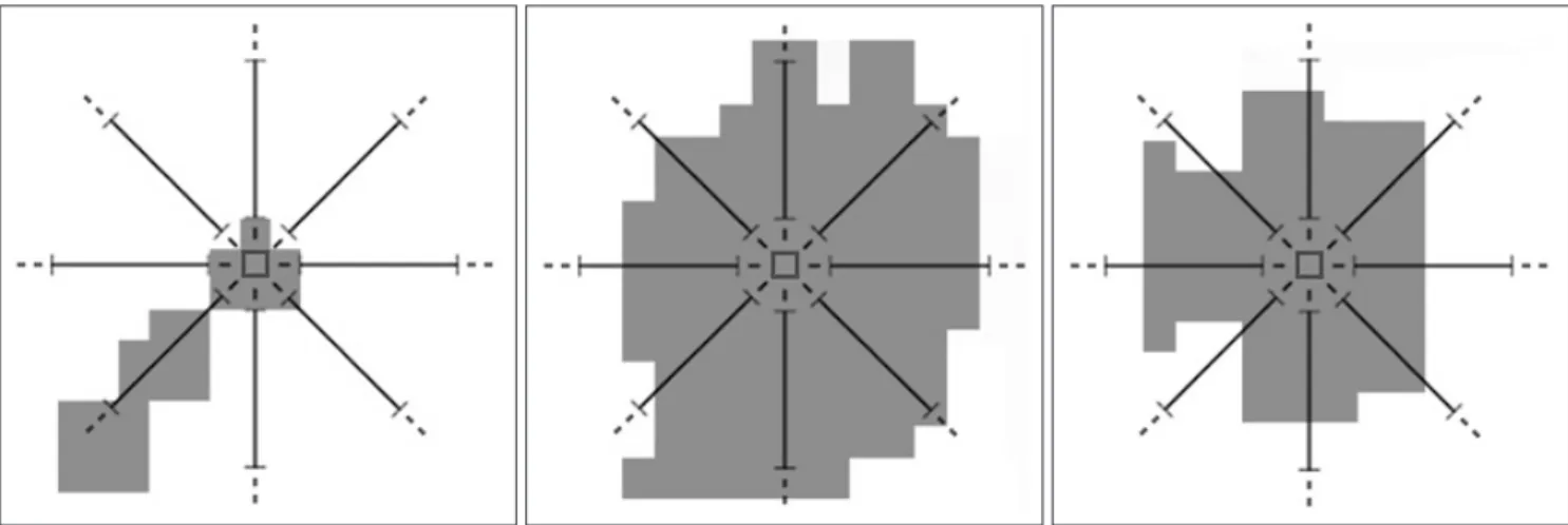 Fig. 6. A. A voxel which doesn’t have a number of adjacent neighbor voxels greater than or equal to the value of “minimum distance threshold”, so it is not a part of the ROI.