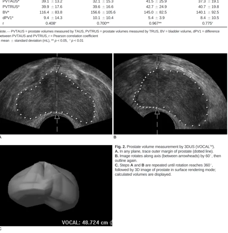 Table 1. Comparison of PVTAUS and PVTRUS 