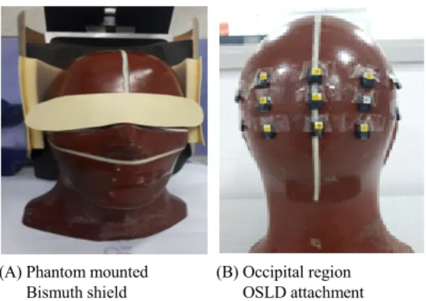 Fig.  2  (A)  Measurement  model  after  installing  bismuth  unshield  and  (B)  shield