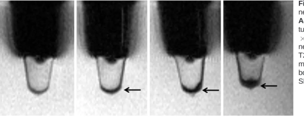 Fig. 2. In vitro T2*-weighted images of neural stem cells.