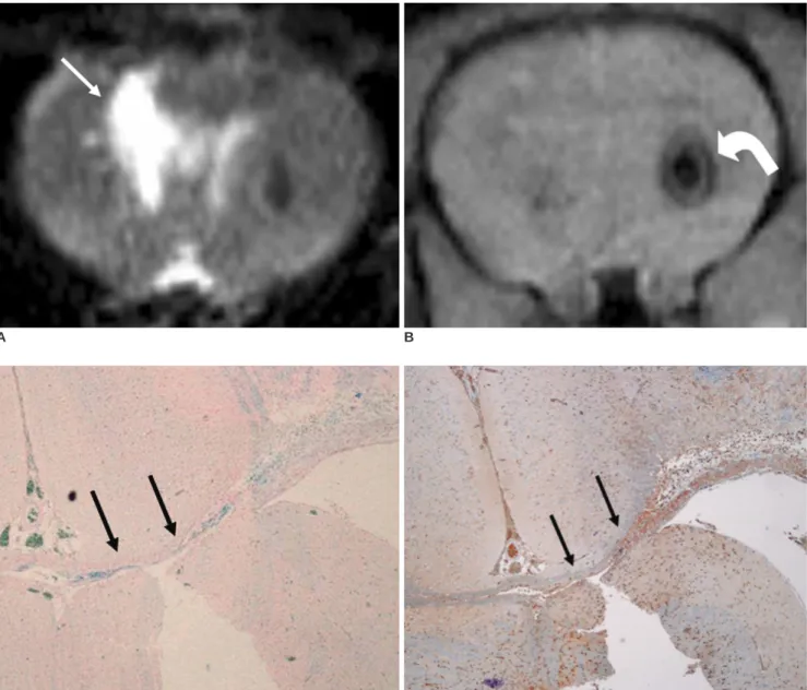 Fig. 4. MR and histological findings two weeks after implantation of neural stem cells.