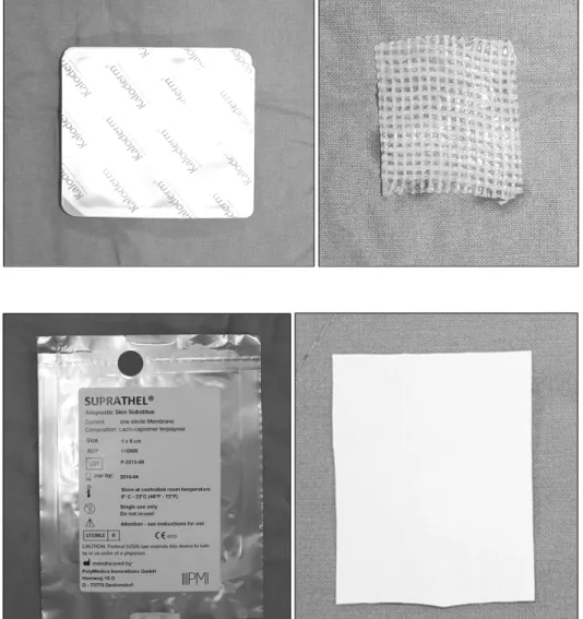 Fig. 2. Synthetic  film  made  of  Lacto-Capromer  and  Polylactic  Acid,  Suprathel ®   (Polymedics  Innovations  GmbH,  Germany  5×5  cm  sized).이용하여  치료하였으며  현재까지  동종유래  배양세포이식과 젖산 융합체 합성창상치료제 적용 시 효과에 대한 비교연구가 진행되지 않아 그 효용성의 차이를 비교,  평가 하기 위한  목적으로  진행