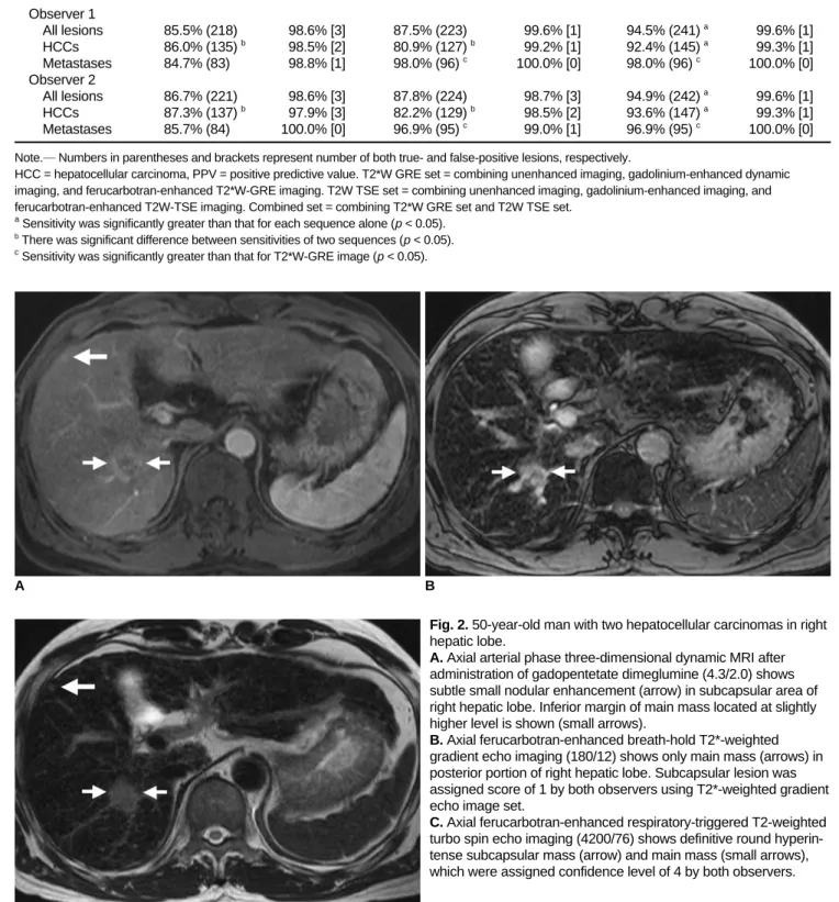 Fig. 2. 50-year-old man with two hepatocellular carcinomas in right hepatic lobe.