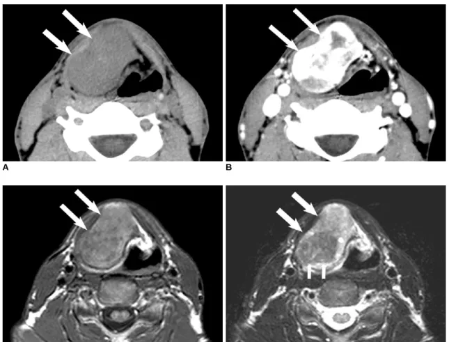Fig. 1. Images of 34-year-old man presenting foreign body sensation in throat.