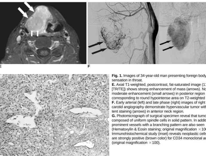 Fig. 1. Images of 34-year-old man presenting foreign body sensation in throat.