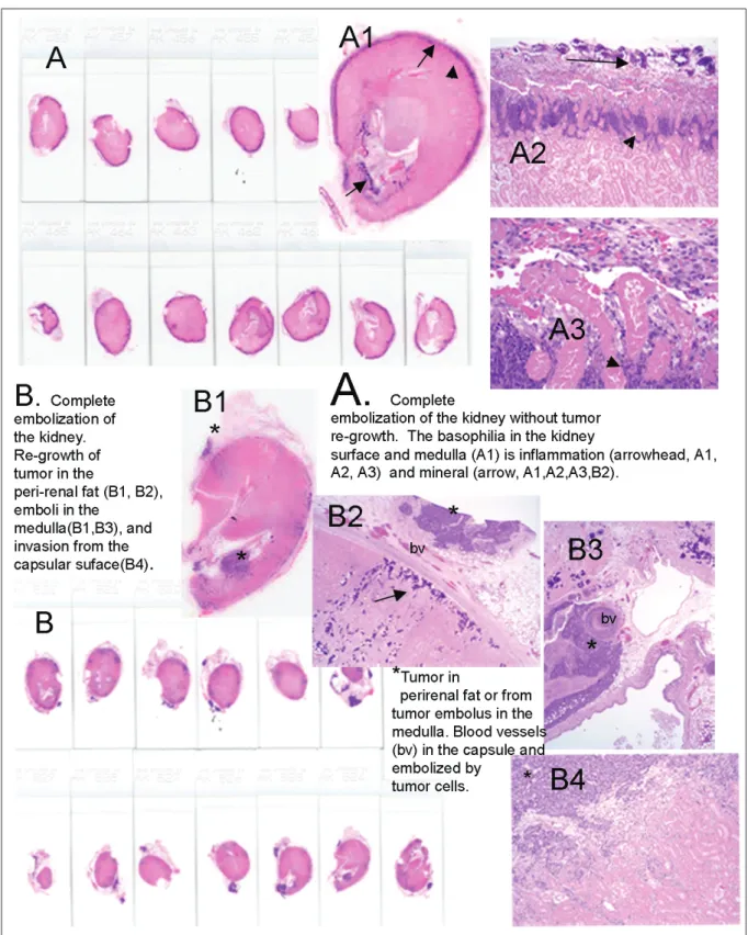 Fig. 6. Embolized kidneys from Groups 6 and 7 demonstrating the pattern of tumor re-growth
