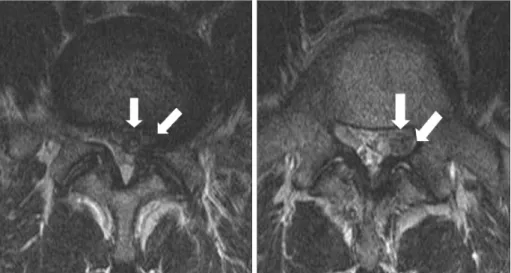 Fig. 5. MRI of a 49-year-old man.