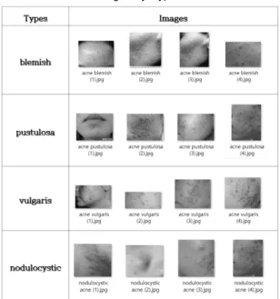 Fig.  3  Preprocessing  of  Dataset