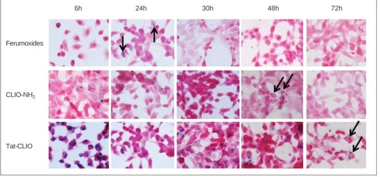 Fig. 2. Retention of SPIONs in hNSCs. Iron oxide nanoparticles (arrows) are seen within the ferumoxides labeled cells and the CLIO- CLIO-NH 2 labeled cells for up to 24 and 48 hr, respectively and inside the tat-CLIO labeled cells for up to 72 hr