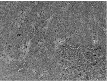 Fig. 3. Intramuscular myxoma. A hypocellular tumor extending into the striated muscle is composed of spindle and stellate cells.