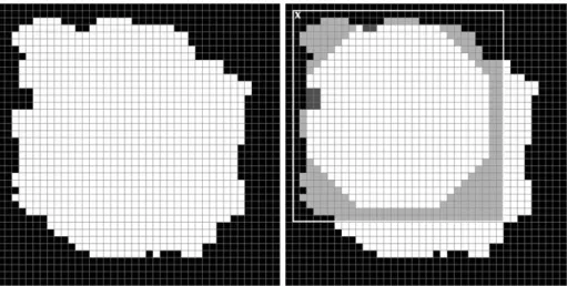 Fig. 5. A. A mammographic mass. 