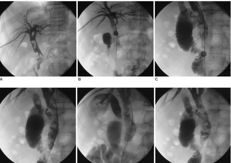 Fig. 2. Fifty-six year-old male complaining of fever and right upper quadrant pain.
