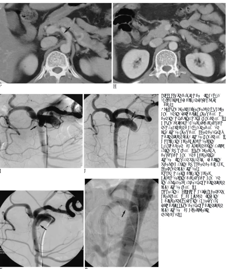 Fig. 2. 54-year-old man with severe epigastric pain after drinking cold water.