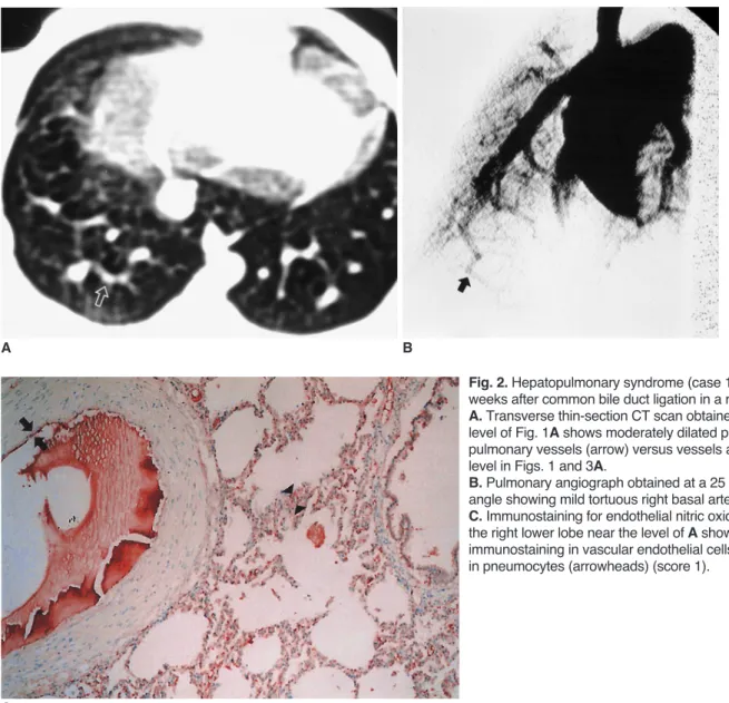 Fig. 2. Hepatopulmonary syndrome (case 1) induced 3 weeks after common bile duct ligation in a rabbit
