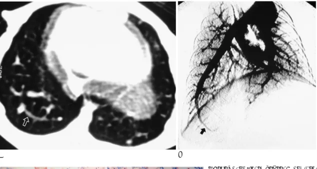 Fig. 3. Control (case 7) - sham operation without common bile duct ligation. 