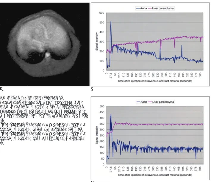 Fig. 1. MR imaging and time-intensity curves.