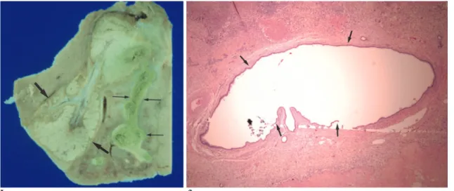 Table 1. Three Dimensions and Volume of Ablation Zones Created in Rabbit Livers with and without Pringle Maneuver