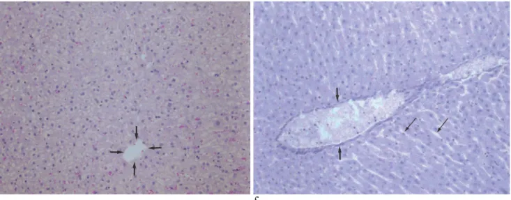 Fig. 5. Microphotographs (H &amp; E, ×100) of the resected specimens obtained immediately after radiofrequency ablation