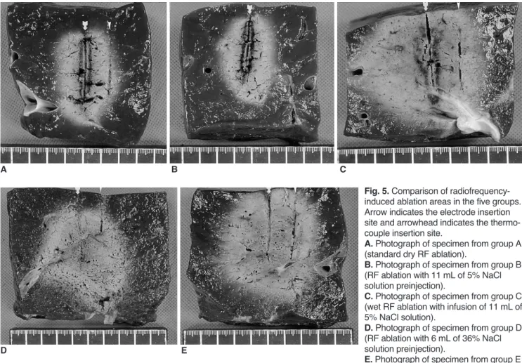 Fig. 5. Comparison of radiofrequency- radiofrequency-induced ablation areas in the five groups.