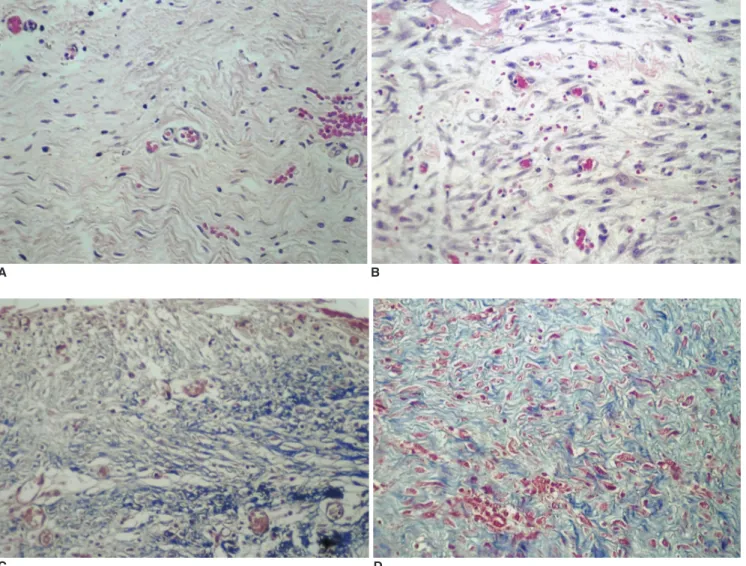 Fig. 3. Histopathologic findings (H &amp; E staining,  200) (A, B) show capillary proliferation, fibroblast proliferation and inflammatory cell infiltration on the 2nd (A) and 4th (B) week specimens
