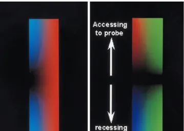 Fig. 1. A. PFD image of a kidney. Interlobar arteries are colored green (arrows) and easily distinguished from other non-pulsatile flows