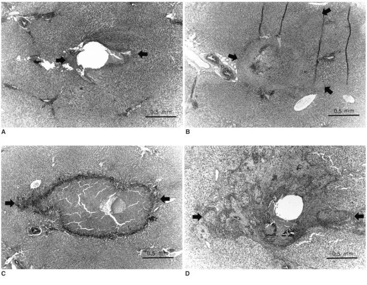 Fig. 5. Light micrographs of rabbit liver after the induction of inter- inter-stitial hyperthermia using a duplex stainless steel thermoseed