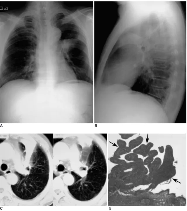 Fig. 3. A 59-year-old man with blood-tinged sputum.