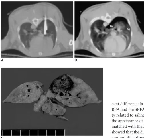 Fig. 2. Saline-enhanced radiofrequency ablation in a rabbit in the  saline-en-hanced radiofrequency group.