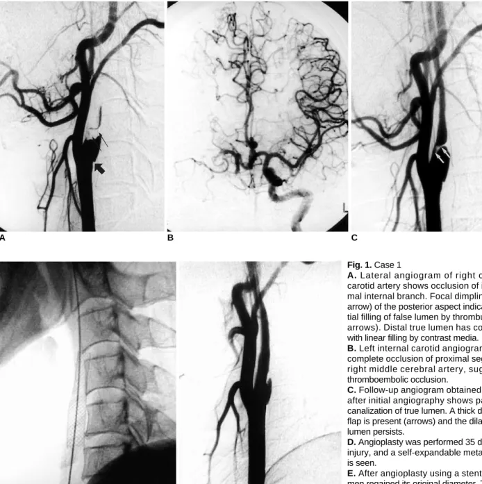 Fig. 1. Case 1 