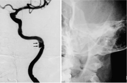 Fig. 2. Case 2 