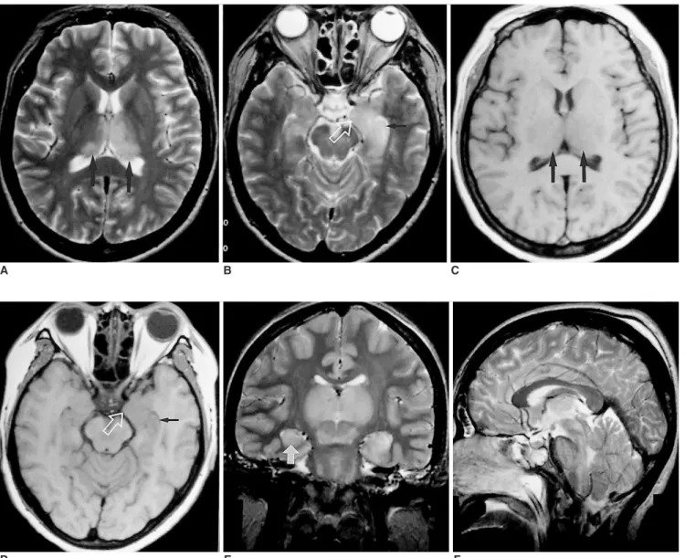 Fig. 1. Case 1. A 40-year-old woman who presented with fever, chill and altered mentality.