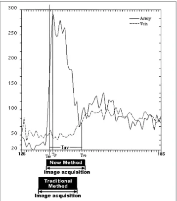 Fig. 6. Arterial and venous time-intensity curves of a test-dose study with comparison of acquisition delay times