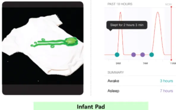 Fig.  2  Smart  Infant  Pad 