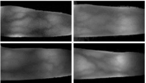 Fig.  1  The  example  of  Vein  image