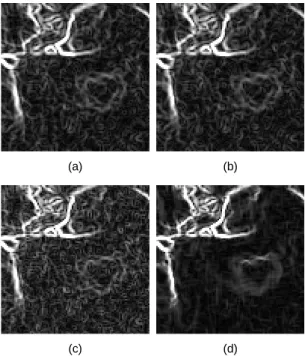 Fig. 7 PSNR for Lena with standard deviation    of  AWGN 5 10 15 20 25 3024262830323436 AWGN()PSNR[dB] Peppers image  A-TMF AWMF SWF PFA