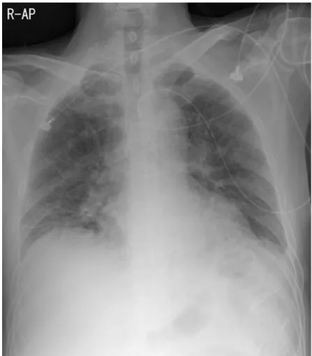 Fig. 1. Initial chest radiography revealed subtle linear opacity in both lower lung fields.