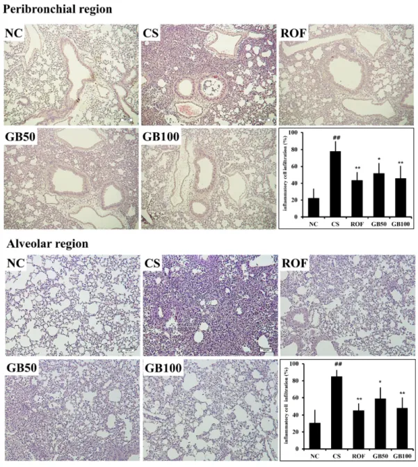 Figure 5. GB attenuated inflammatory cell infiltration. NC: non-treated mice; CS: CS- and LPS-exposed mice; ROF: CS- and LPS- LPS-exposed mice administered roflumilast (10 mg/kg, per os); GB50 and GB100: CS- and LPS-LPS-exposed mice administered GB (50 and