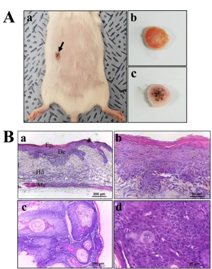 Figure 2. Tumor formation on the skin surface of DT-treated p27 (IΔ) KO mice. (A) Tumor morphology