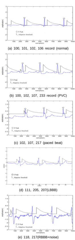 Fig. 4 Detected R wave according to optimal value