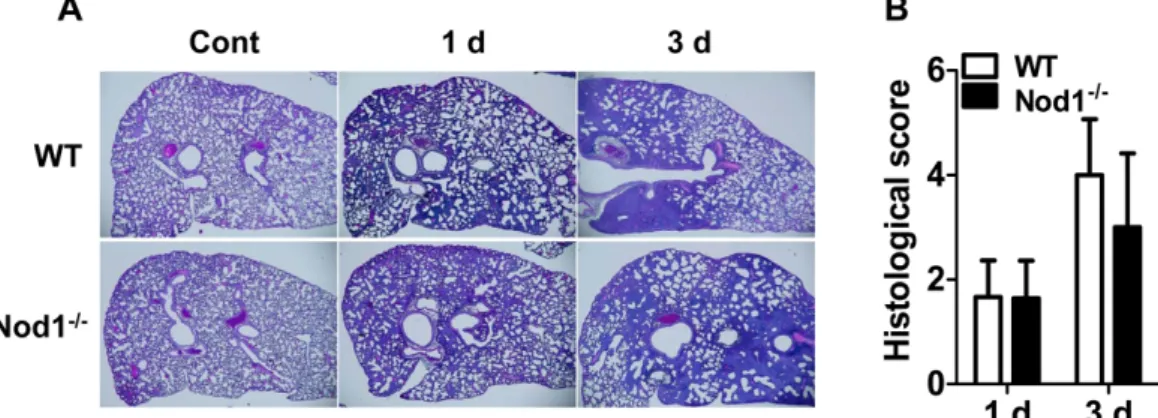 Figure 3. Lung pathology in WT and Nod1-deficient mice infected with A. baumannii. Lung pathology in WT and Nod1-deficient mice (n=5-6 mice per group) infected with A