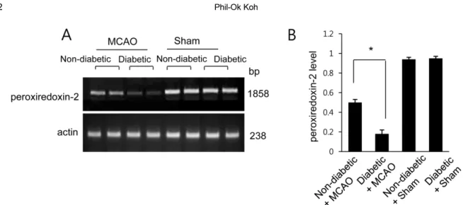 Figure 2. Reverse transcriptase-PCR of peroxiredoxin 2 in the cerebral cortex of non-diabetic+sham, diabetic+sham, non- non-diabetic+middle cerebral artery occlusion (MCAO), and diabetic+MCAO animals