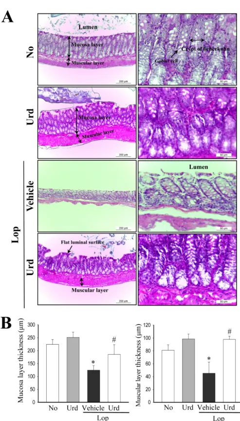 Figure 2. Alteration of the histological structure in transverse colons. (A) Hematoxylin and eosin (H&amp;E) stained sections of transverse colons from the No treated group, Lop+Vehicle treated group or Lop+Urd treated group were observed at two different 