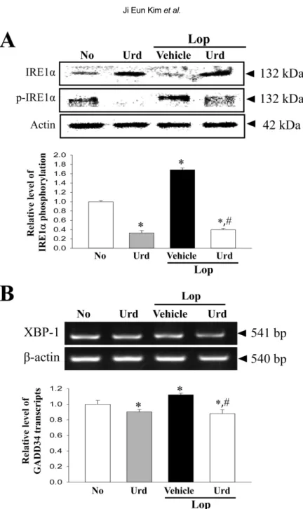 Figure 4. Expression of marker proteins in IRE1α/XBP pathway. (A) The expression levels of IRE1α and p- IRE1α in total proteins were detected with specific antibodies