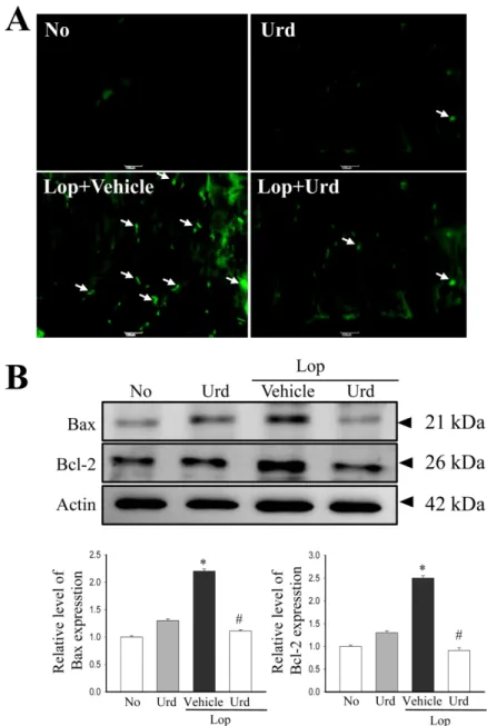 Figure 5. Level of apoptotic cells and proteins. (A) Representative images show staining of TUNEL in transverse colon treated with Lop+Vehicle or Lop+Urd as indicated